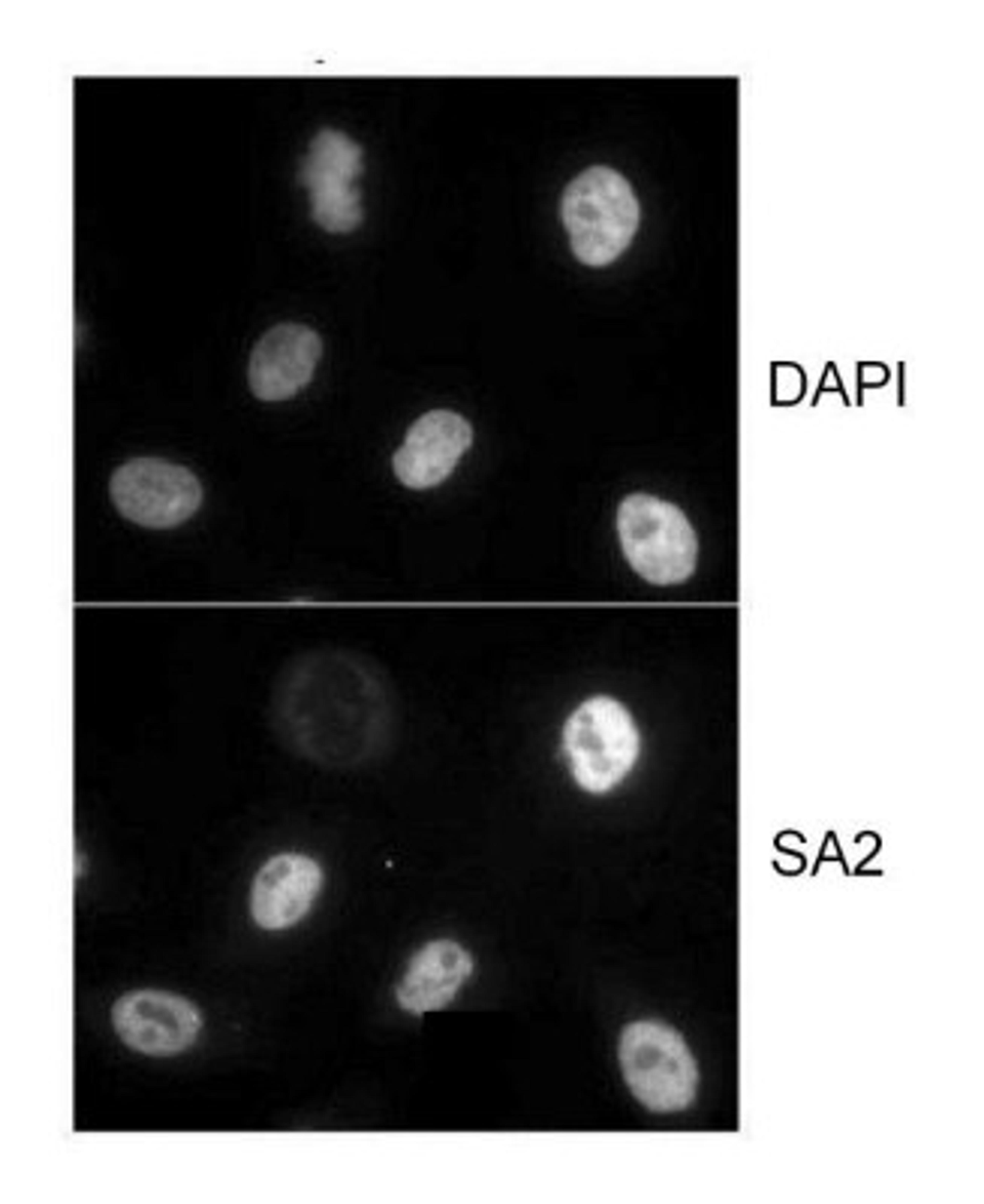 Immunocytochemistry/Immunofluorescence: STAG2 Antibody [NB100-300] - HeLa cells that were extracted for 5 min. at 4C in 0.5% Triton in CSK buffer.  Antibody used at 1 ug/ml.