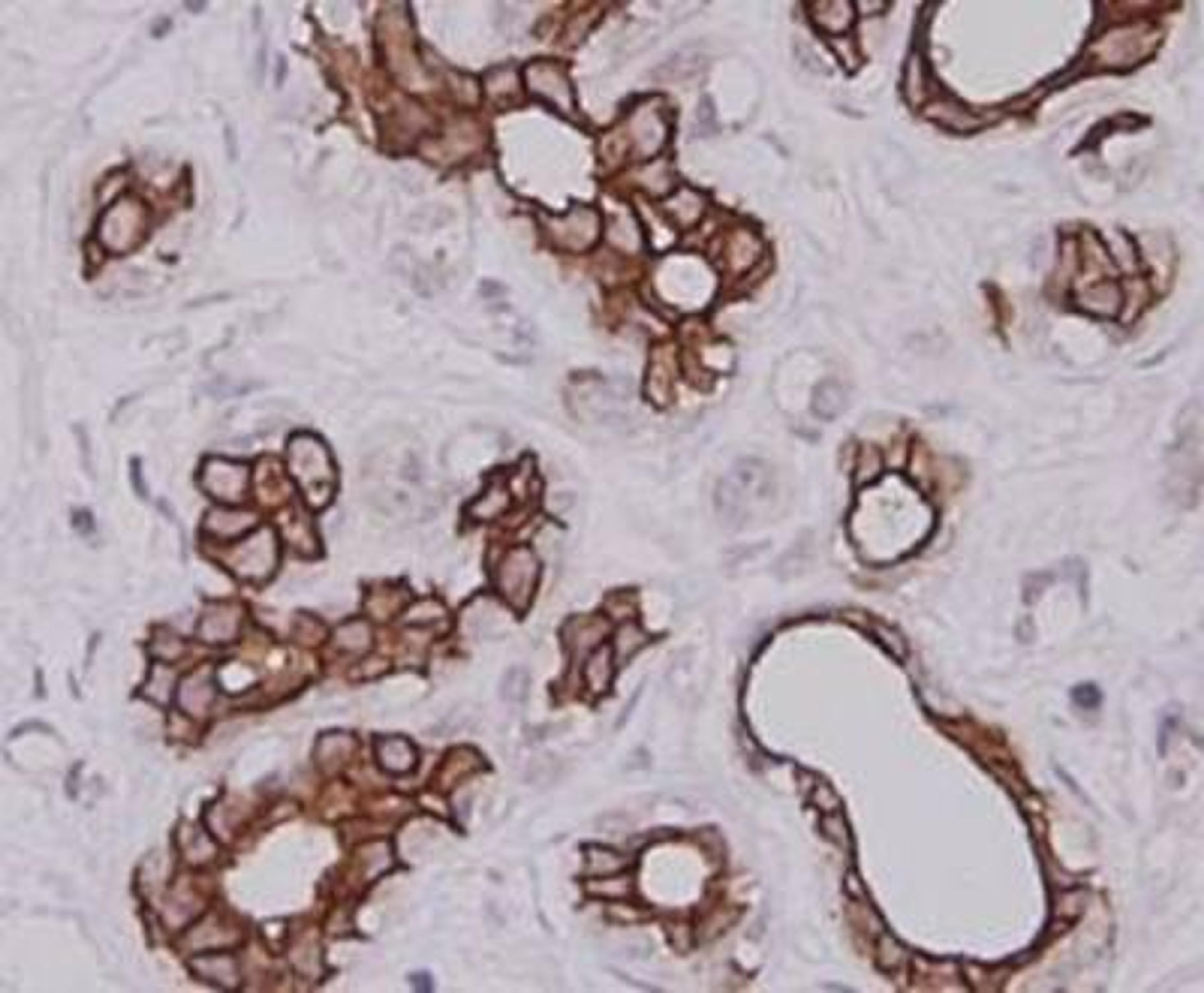 Immunohistochemical staining of human breast tissue using Cytokeratin-7 antibody