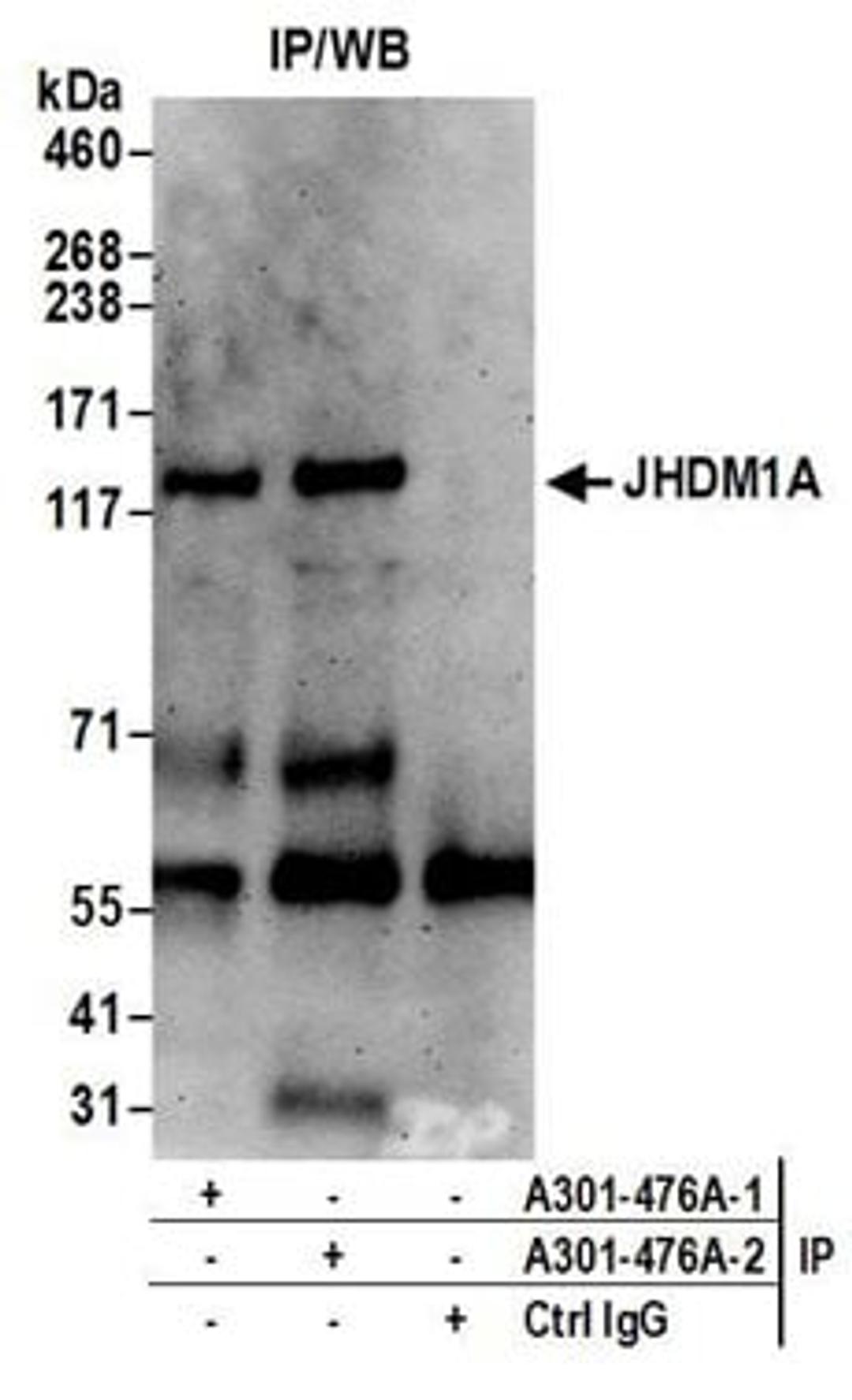 Detection of human JHDM1A by western blot of immunoprecipitates.