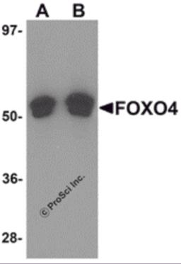 Western blot analysis of FOXO4 in A-20 cell lysate with FOXO4 antibody at (A) 0.5 and (B) 1 &#956;g/mL.