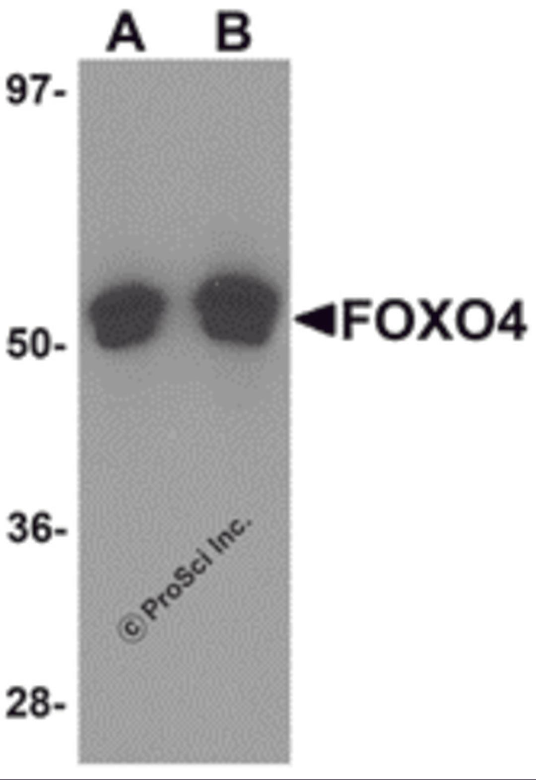 Western blot analysis of FOXO4 in A-20 cell lysate with FOXO4 antibody at (A) 0.5 and (B) 1 μg/mL.
