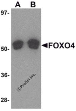 Western blot analysis of FOXO4 in A-20 cell lysate with FOXO4 antibody at (A) 0.5 and (B) 1 μg/mL.