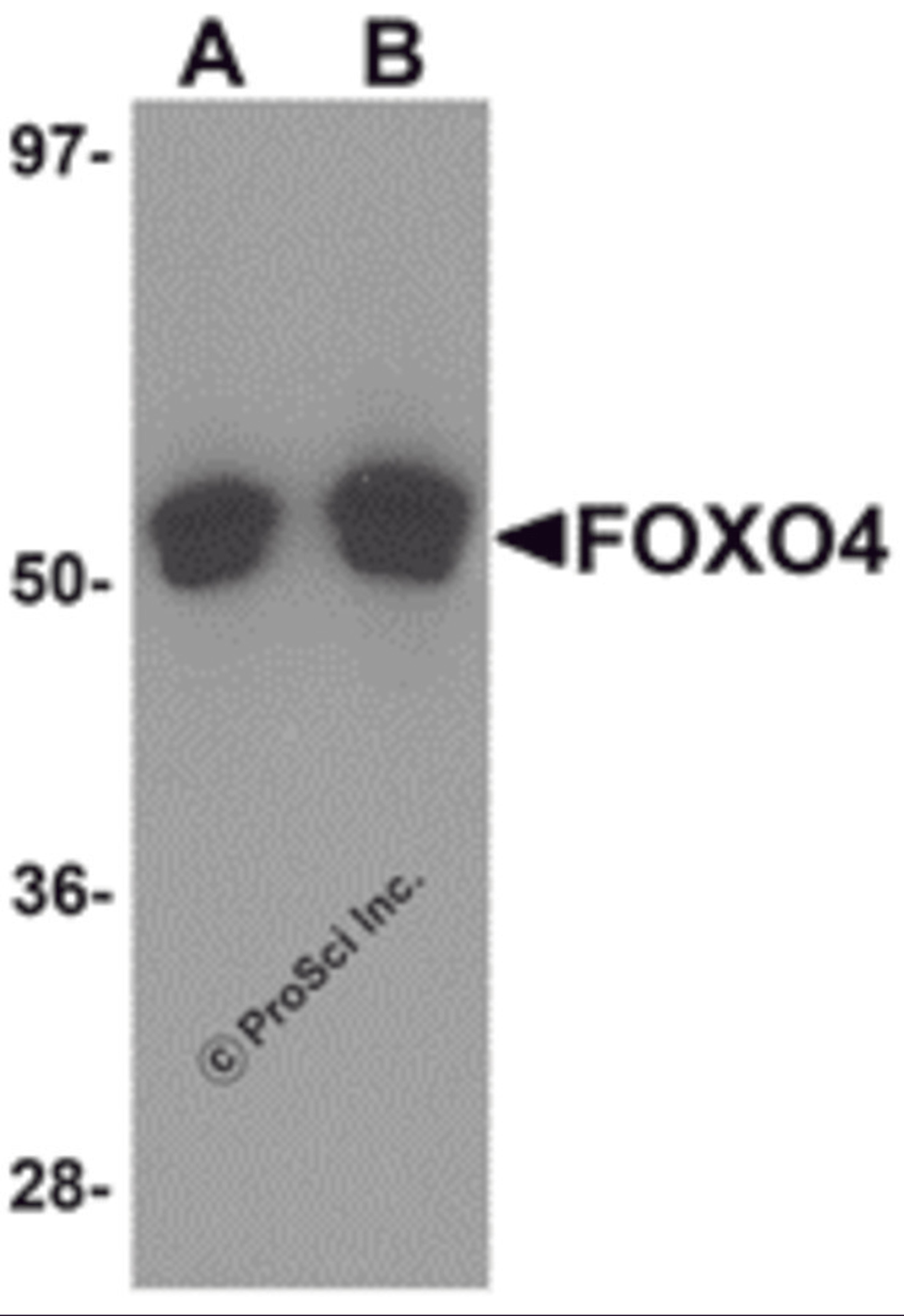 Western blot analysis of FOXO4 in A-20 cell lysate with FOXO4 antibody at (A) 0.5 and (B) 1 μg/mL.