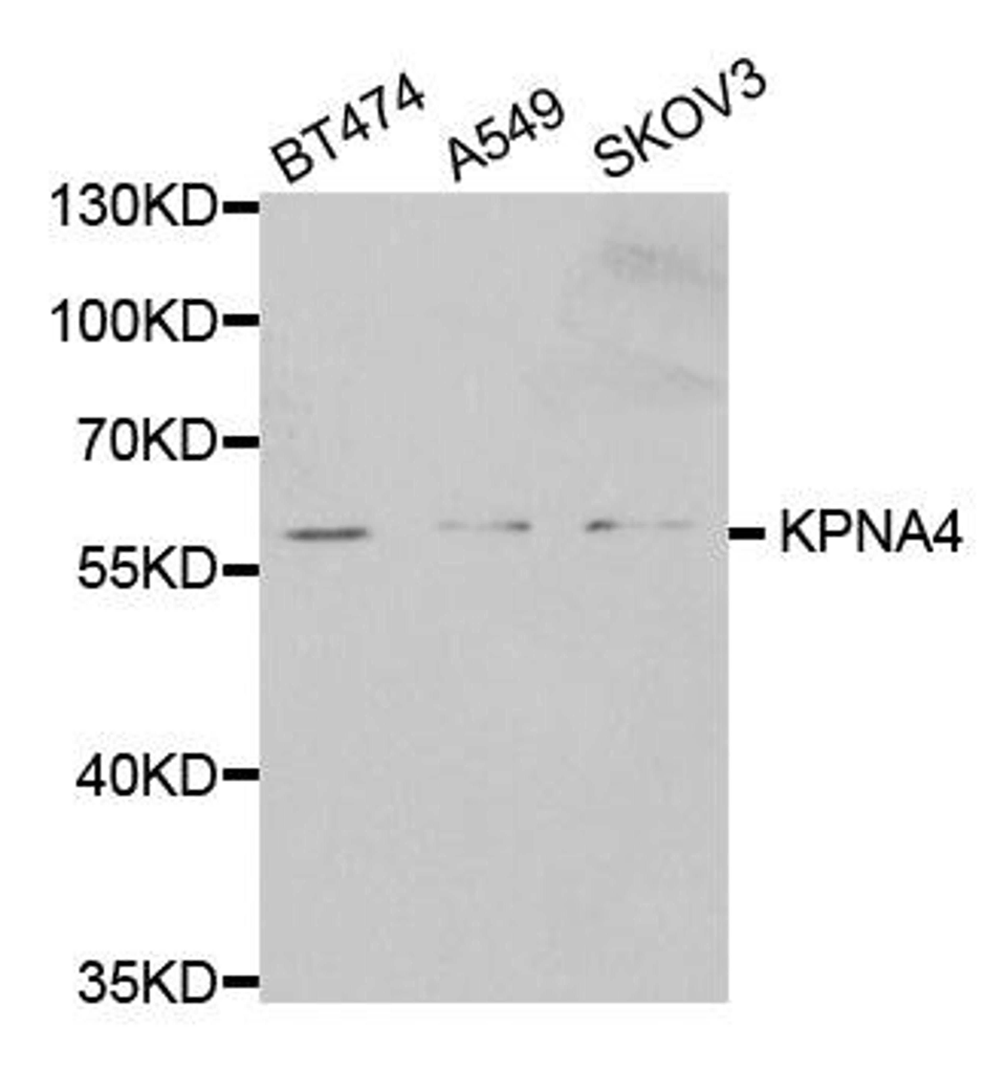 Western blot analysis of extracts of various cell lines using KPNA4 antibody