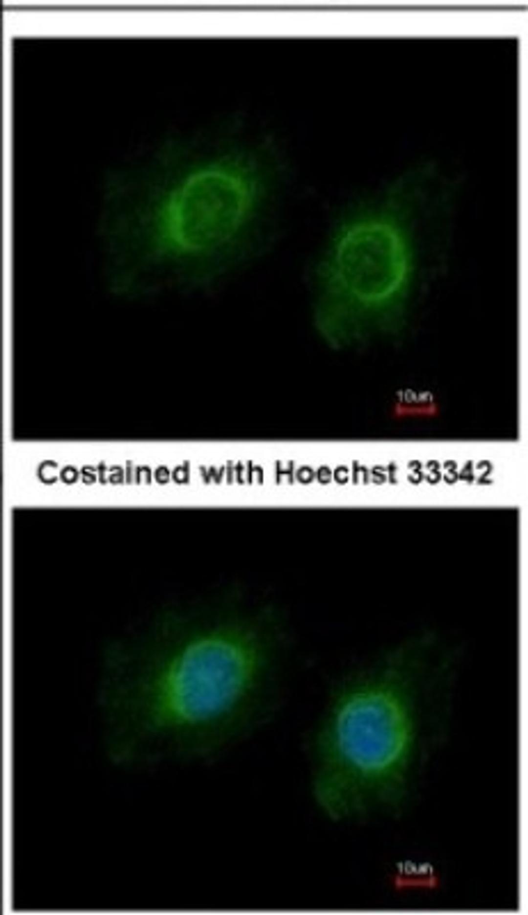 Immunocytochemistry/Immunofluorescence: CYP3A43 Antibody [NBP2-16064] - Immunofluorescence analysis of methanol-fixed HeLa, using antibody at 1:200 dilution.