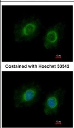 Immunocytochemistry/Immunofluorescence: CYP3A43 Antibody [NBP2-16064] - Immunofluorescence analysis of methanol-fixed HeLa, using antibody at 1:200 dilution.