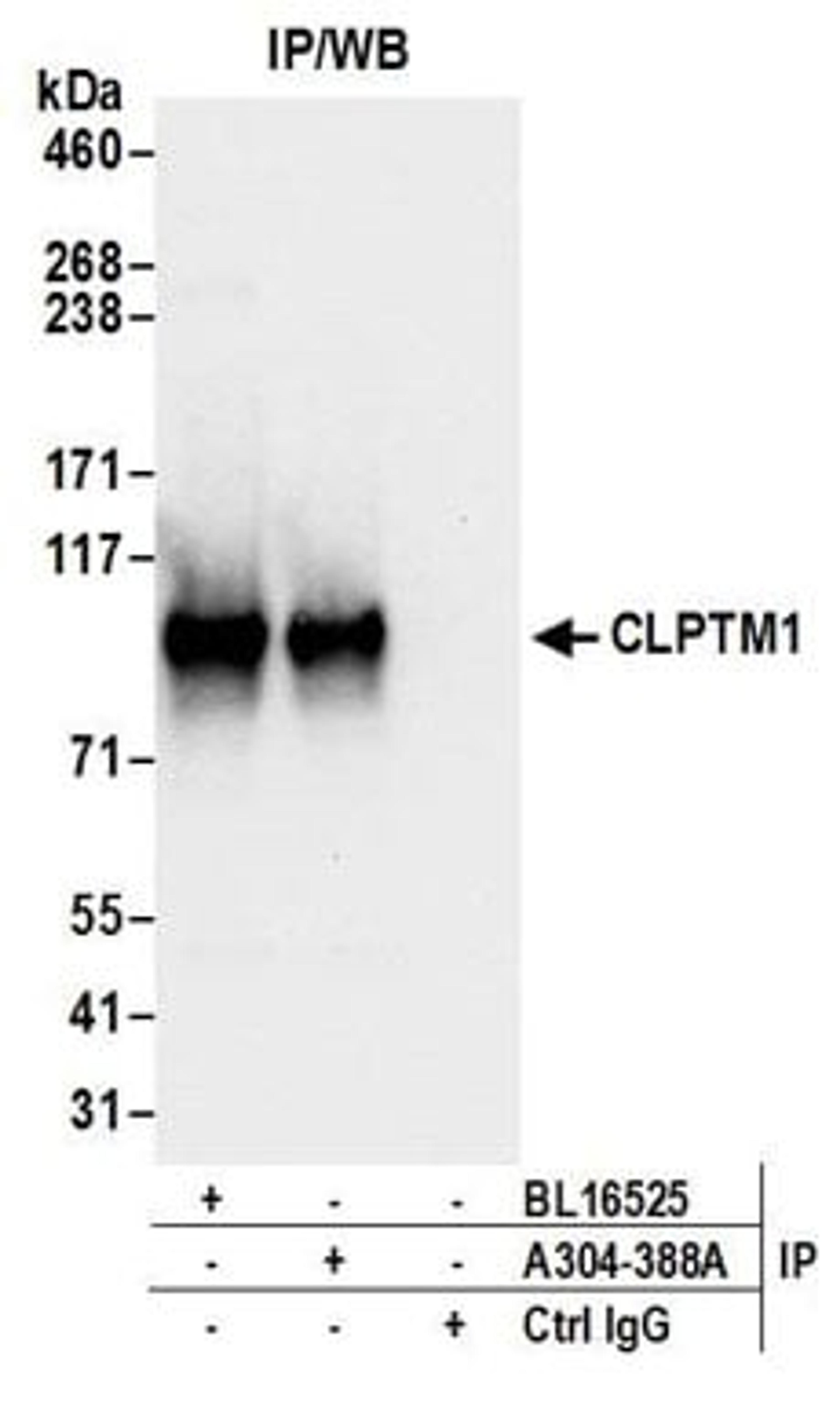 Detection of human CLPTM1 by western blot of immunoprecipitates.