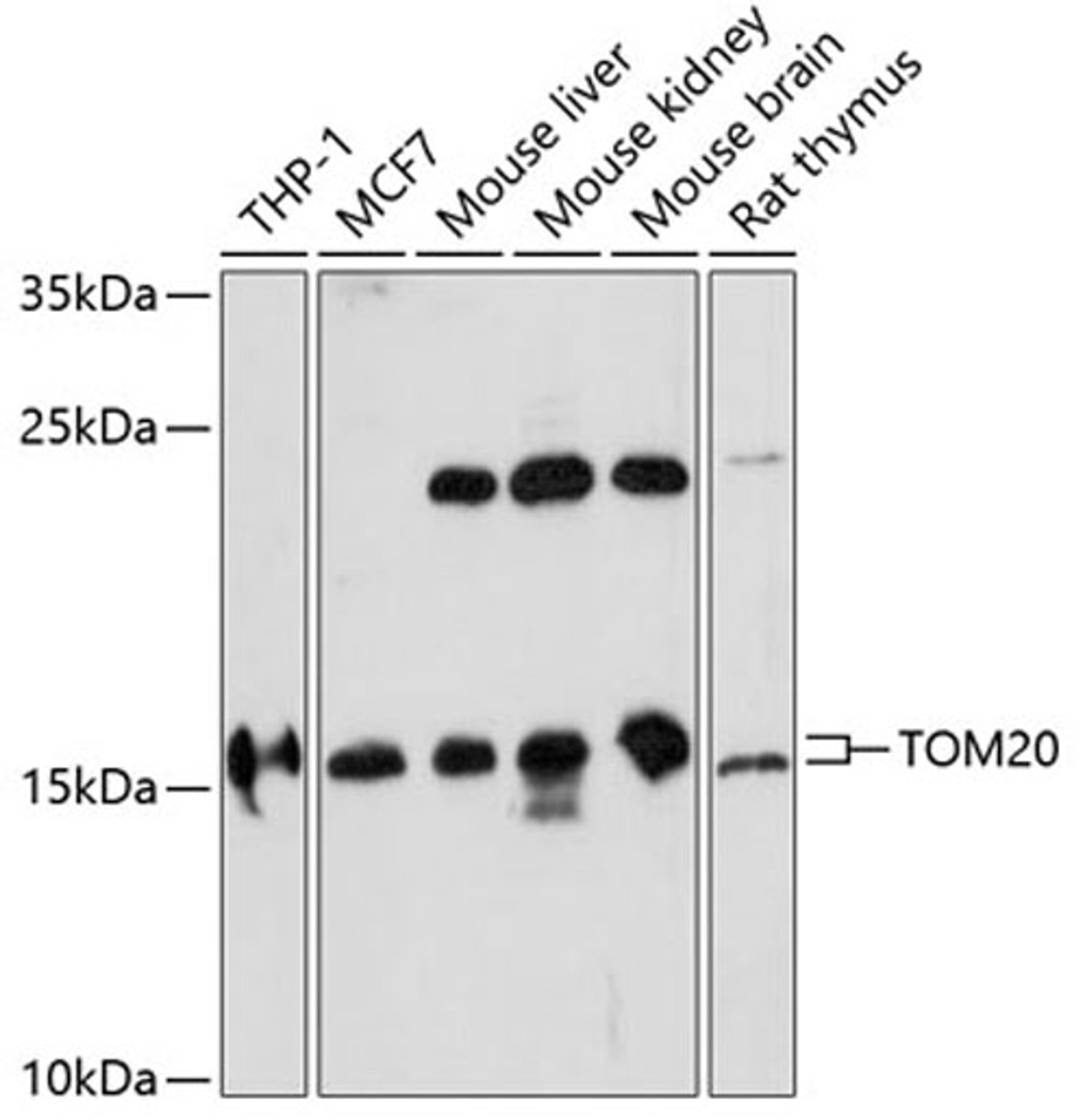 Western blot - TOM20 antibody (A16896)