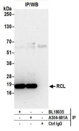 Detection of human RCL by western blot of immunoprecipitates.