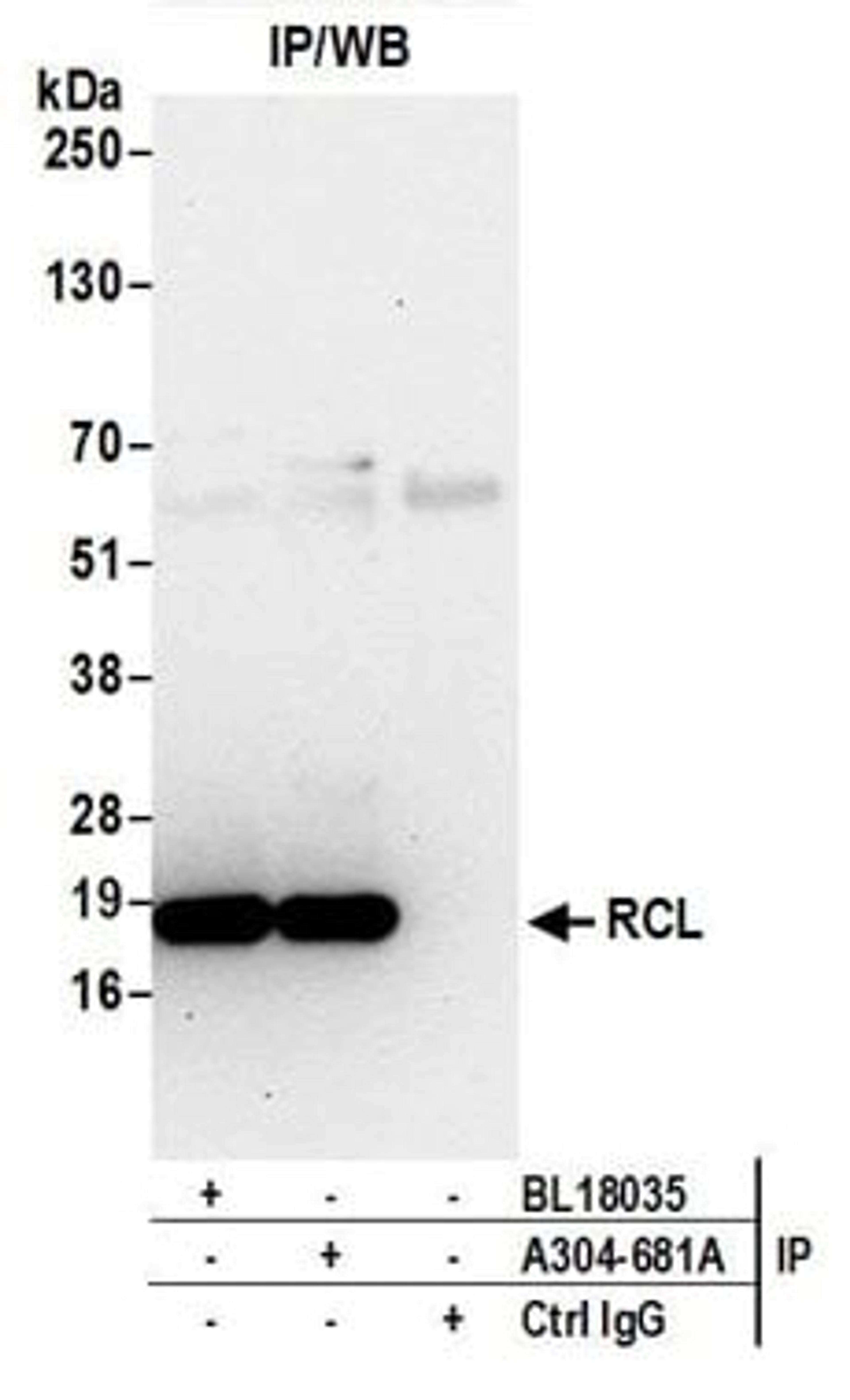 Detection of human RCL by western blot of immunoprecipitates.