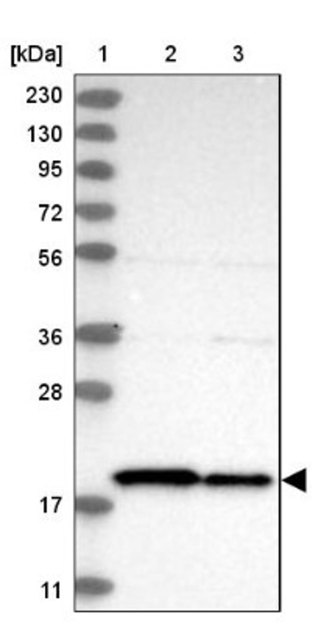 Western Blot: TIMM17B Antibody [NBP1-84036] - Lane 1: Marker [kDa] 230, 130, 95, 72, 56, 36, 28, 17, 11<br/>Lane 2: Human cell line RT-4<br/>Lane 3: Human cell line U-251MG sp