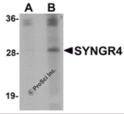 Western blot analysis of SYNGR4 in K562 cell lysate with SYNGR4 antibody at (A) 1 and (B) 2 μg/mL.