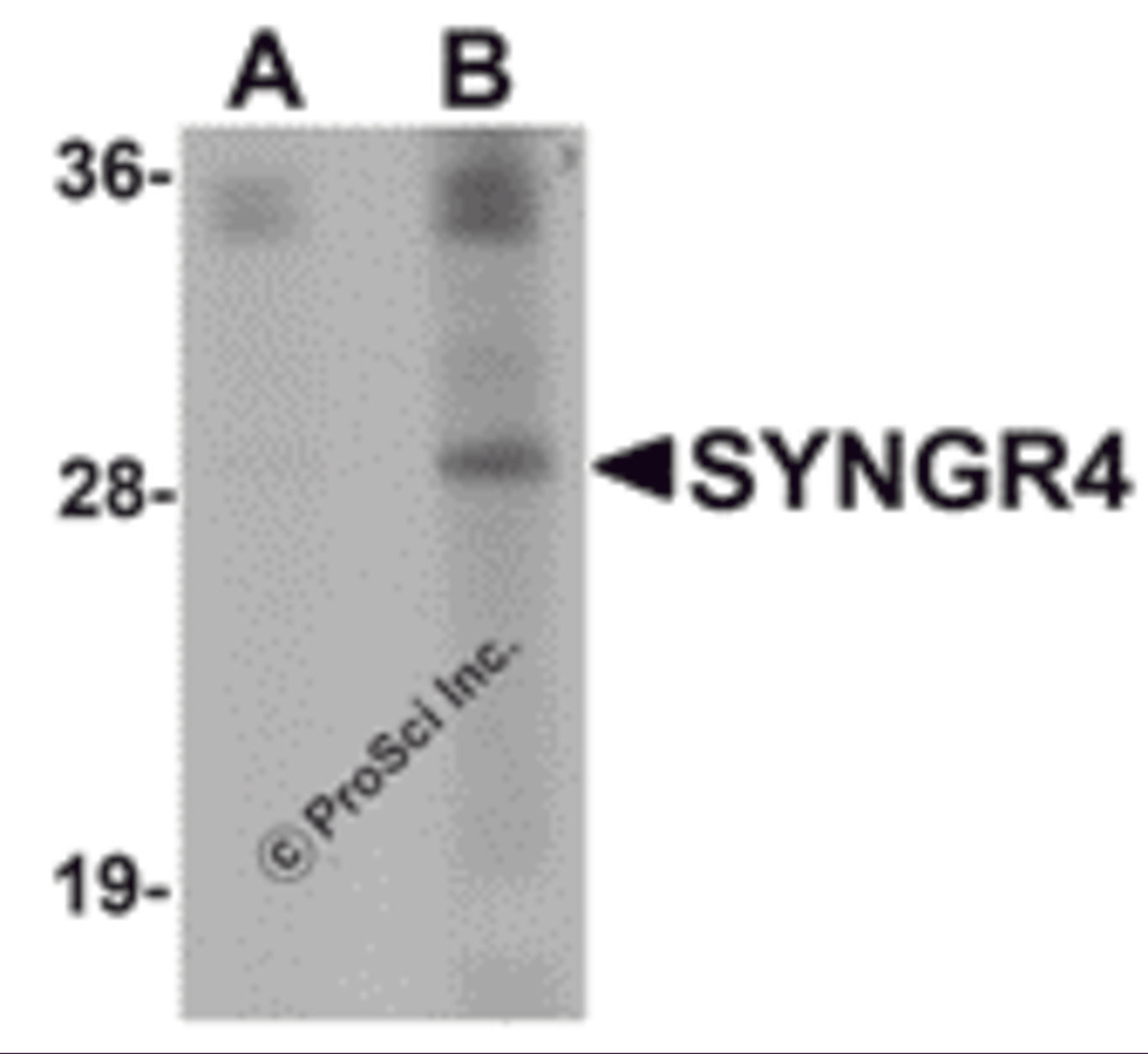 Western blot analysis of SYNGR4 in K562 cell lysate with SYNGR4 antibody at (A) 1 and (B) 2 μg/mL.