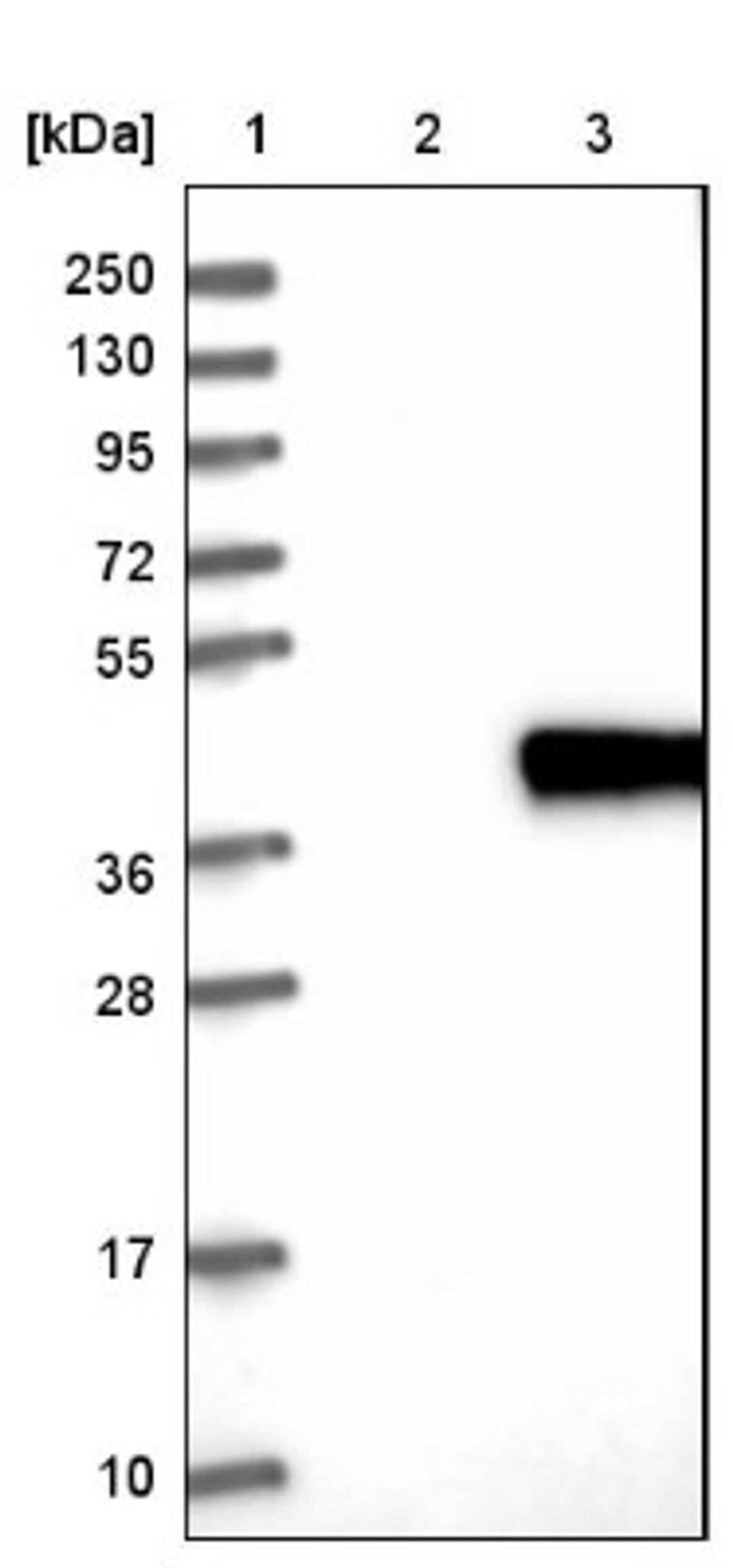 Western Blot: APPD Antibody [NBP1-90124] - Lane 1: Marker [kDa] 250, 130, 95, 72, 55, 36, 28, 17, 10<br/>Lane 2: Negative control (vector only transfected HEK293T lysate)<br/>Lane 3: Over-expression lysate (Co-expressed with a C-terminal myc-DDK tag (~3.1 kDa) in mammalian HEK293T cells, LY402983)