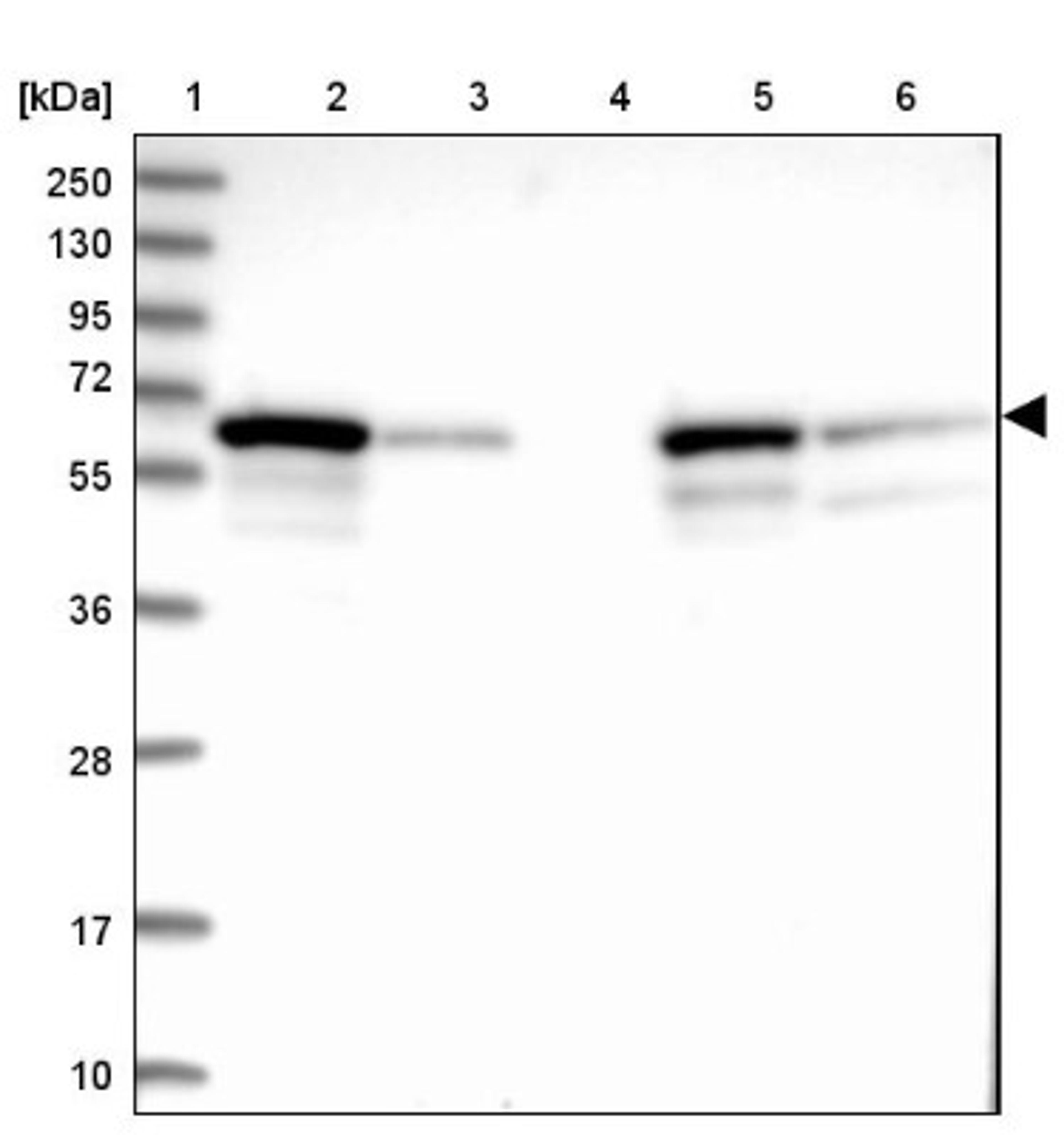 Western Blot: C14orf159 Antibody [NBP1-81920] - Lane 1: Marker [kDa] 250, 130, 95, 72, 55, 36, 28, 17, 10<br/>Lane 2: Human cell line RT-4<br/>Lane 3: Human cell line U-251MG sp<br/>Lane 4: Human plasma (IgG/HSA depleted)<br/>Lane 5: Human liver tissue<br/>Lane 6: Human tonsil tissue