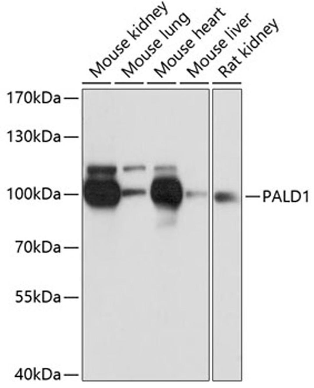 Western blot - PALD1 antibody (A12893)