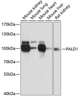 Western blot - PALD1 antibody (A12893)