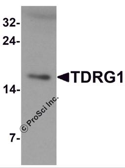 Western blot analysis of TDRG1 in human testis tissue lysate with TDRG1 antibody at 1 μg/mL.