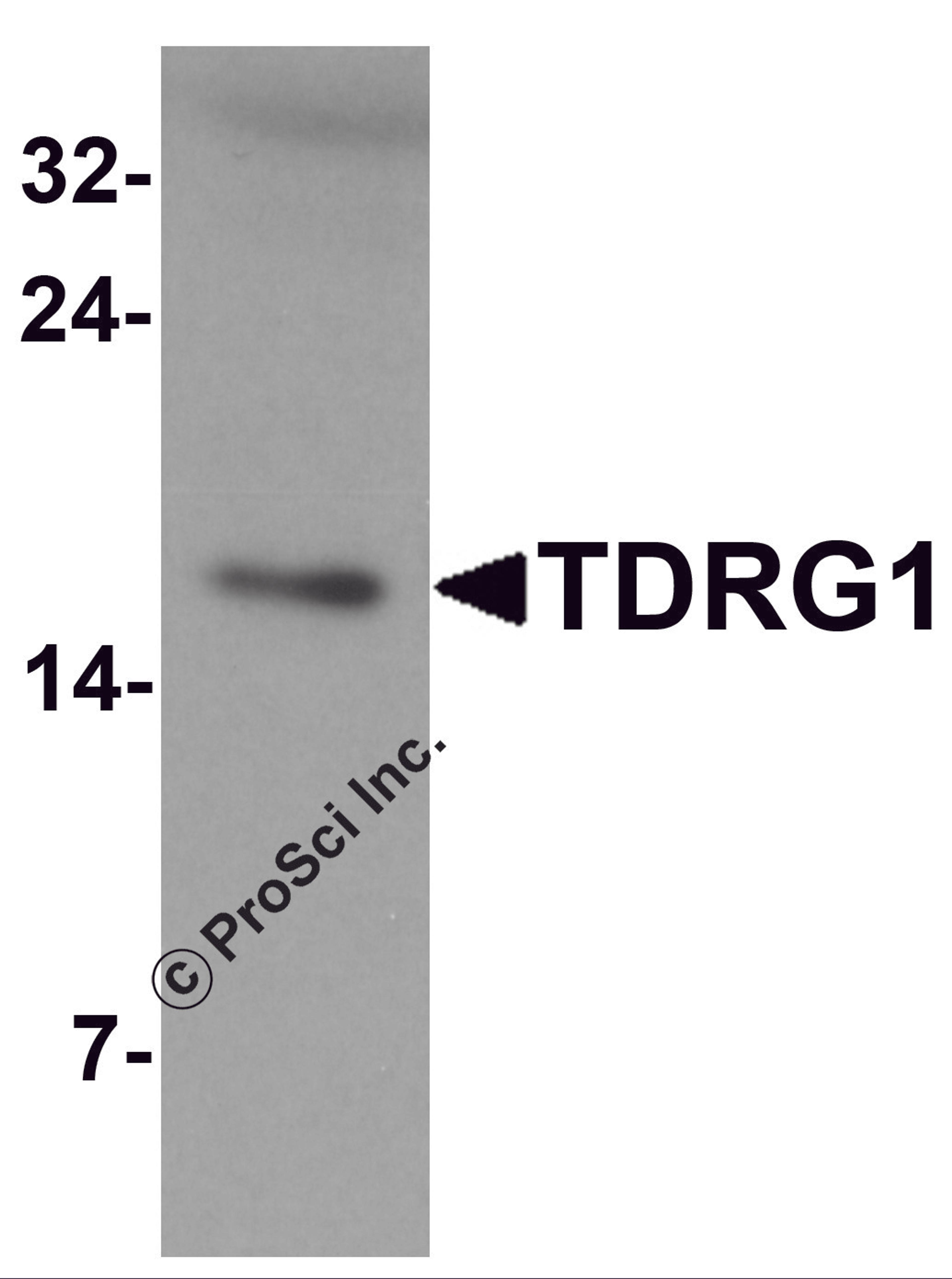 Western blot analysis of TDRG1 in human testis tissue lysate with TDRG1 antibody at 1 μg/mL.