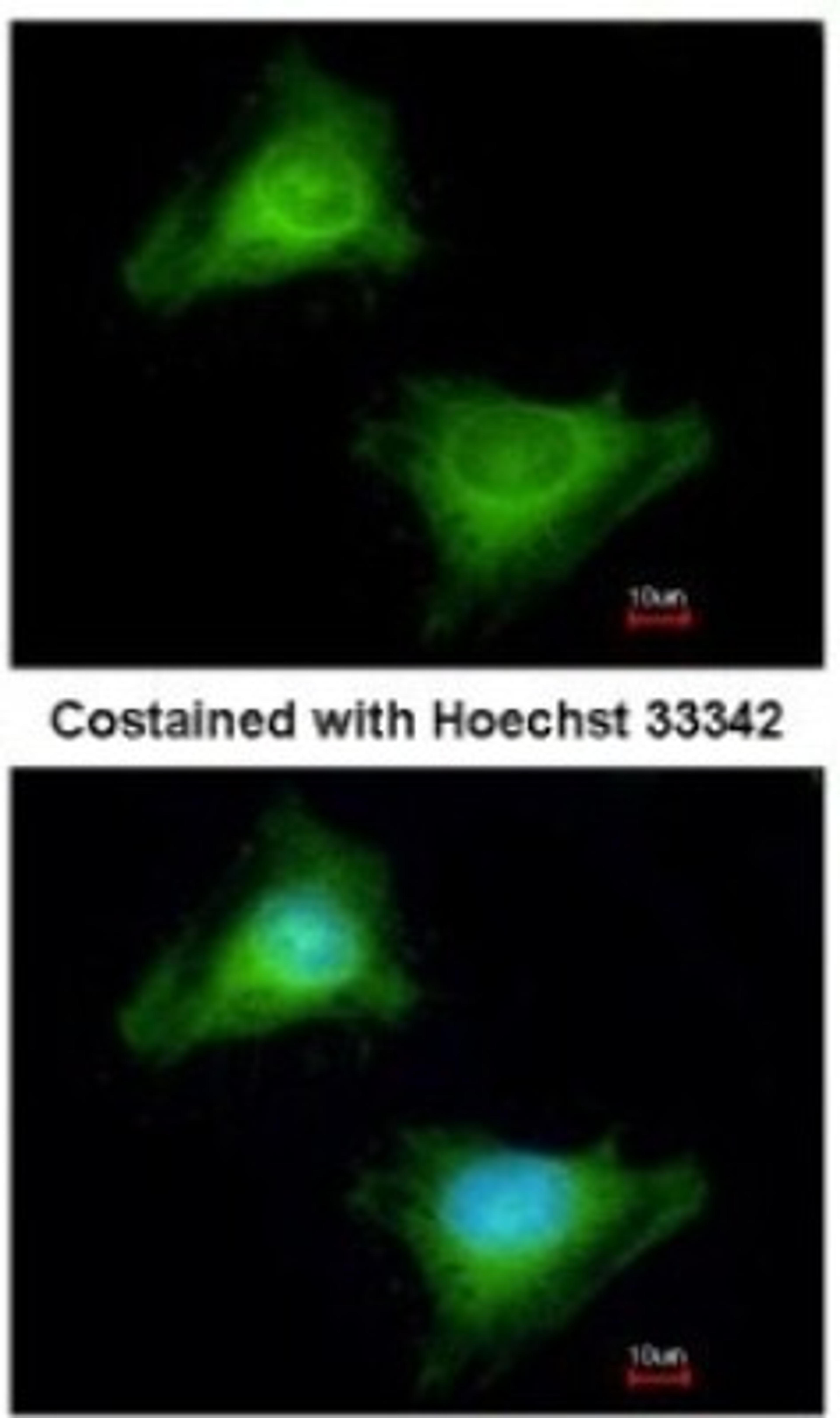 Immunocytochemistry/Immunofluorescence: GBP3 Antibody [NBP1-31714] - Analysis of methanol-fixed HeLa, using antibody at 1:200 dilution.