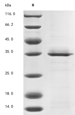 (Tris-Glycine gel) Discontinuous SDS-PAGE (reduced) with 5% enrichment gel and 15% separation gel.