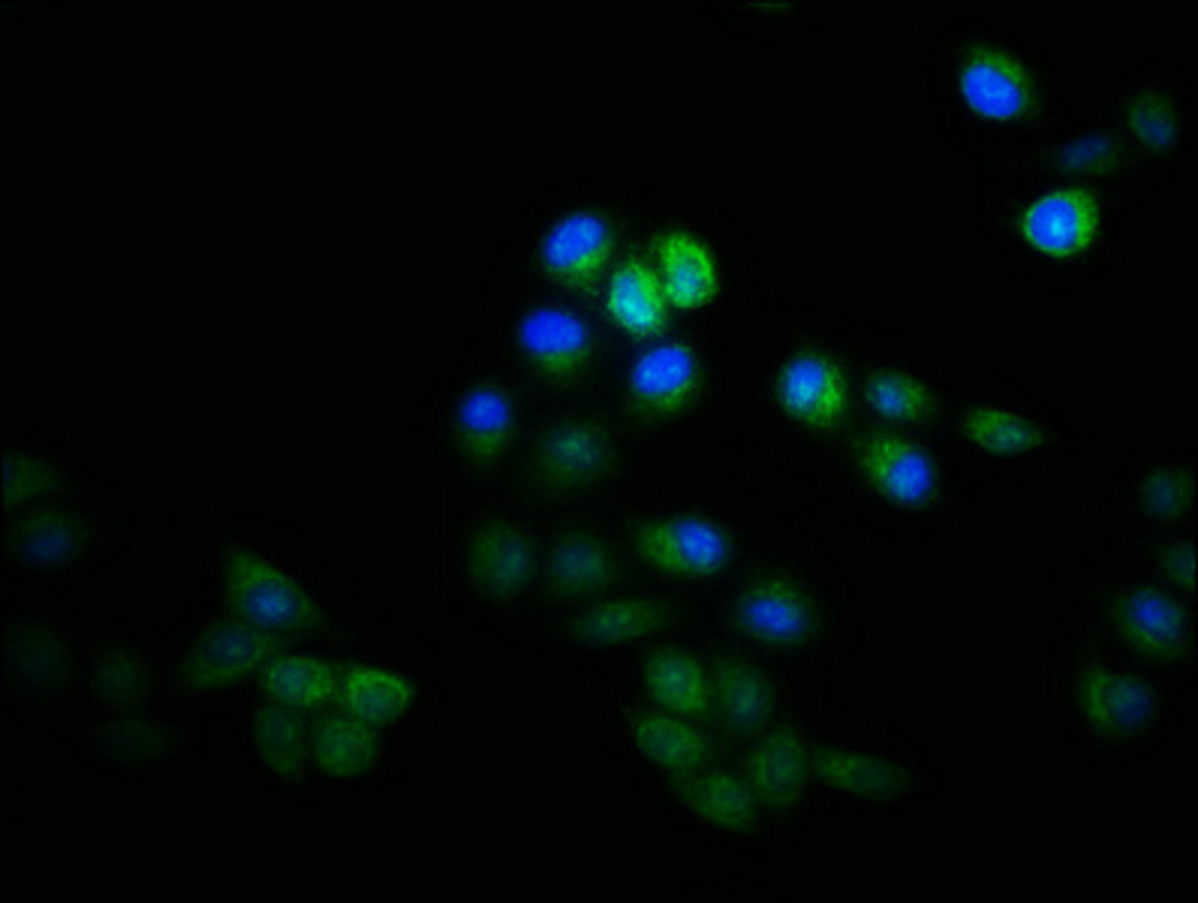 Immunofluorescence staining of Hela cells with CSB-PA11269A0Rb at 1:133, counter-stained with DAPI. The cells were fixed in 4% formaldehyde, permeabilized using 0.2% Triton X-100 and blocked in 10% normal Goat Serum. The cells were then incubated with the antibody overnight at 4°C. The secondary antibody was Alexa Fluor 488-congugated AffiniPure Goat Anti-Rabbit IgG(H+L).