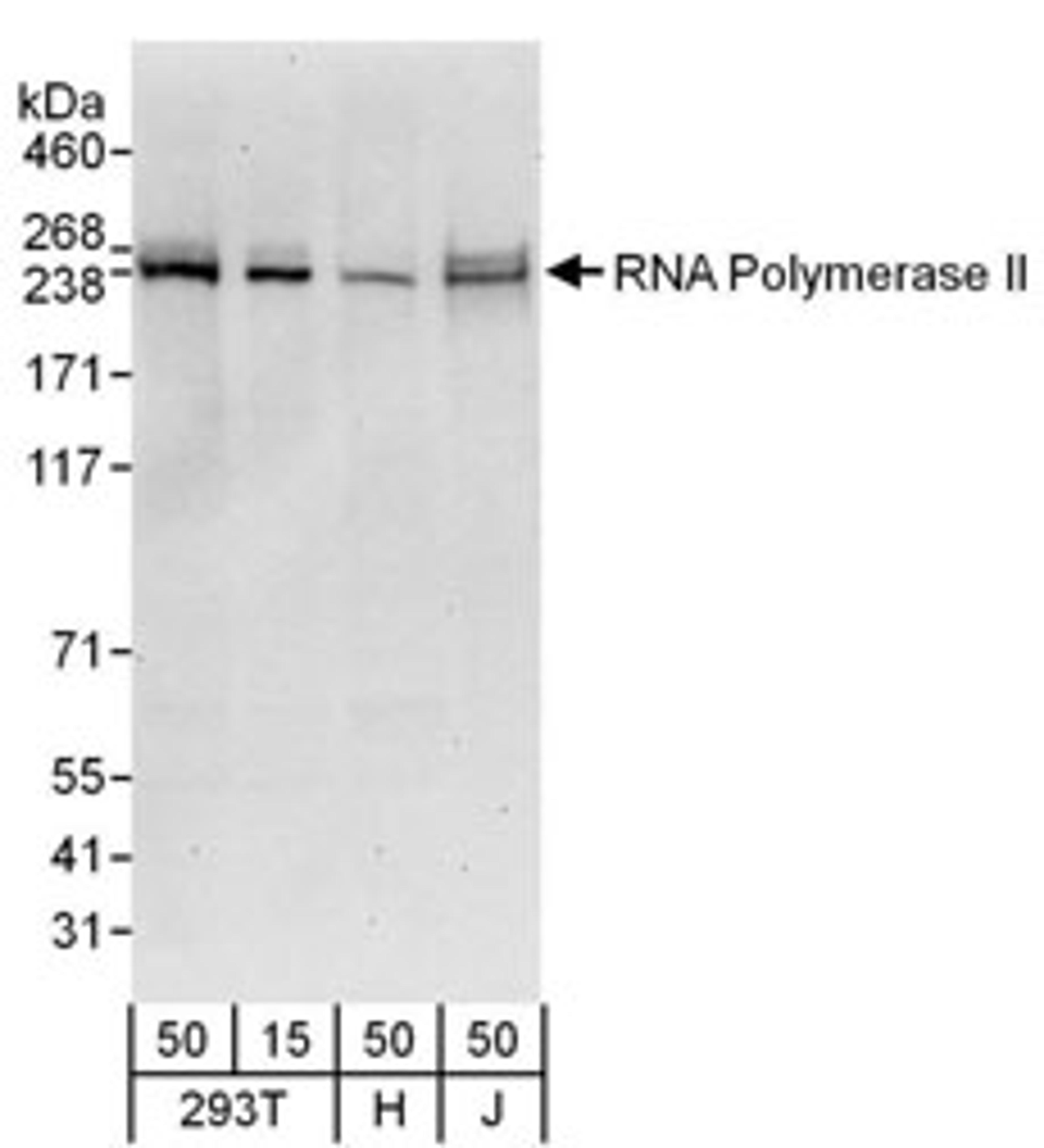 Detection of human RNA Polymerase II by western blot.