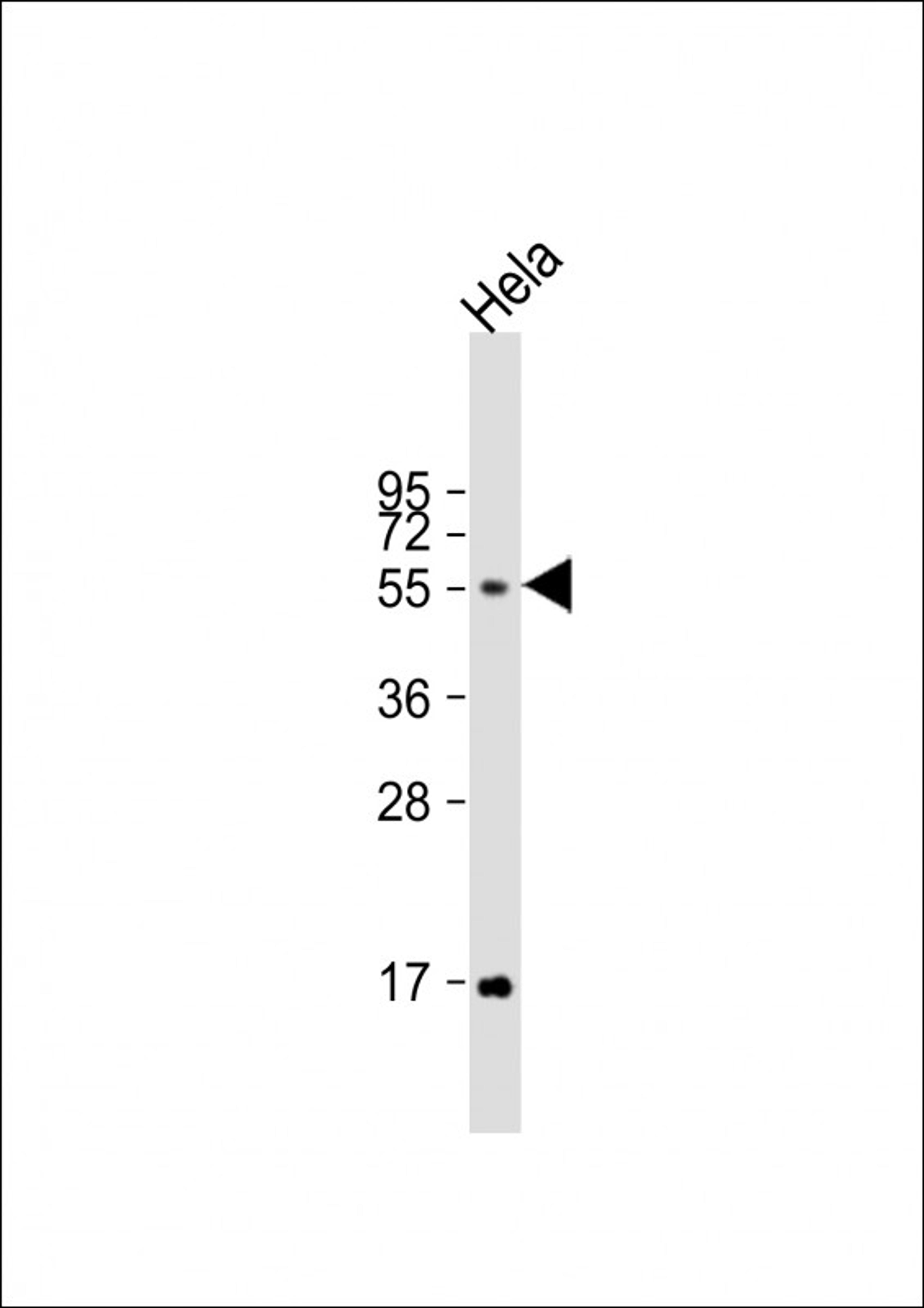 Western Blot at 1:1000 dilution + Hela whole cell lysate Lysates/proteins at 20 ug per lane.