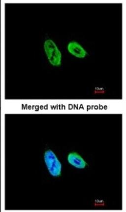 Immunocytochemistry/Immunofluorescence: p27 KIP 1 Antibody [NBP1-32213] - Paraformaldehyde-fixed HeLa, using antibody at 1:200 dilution.