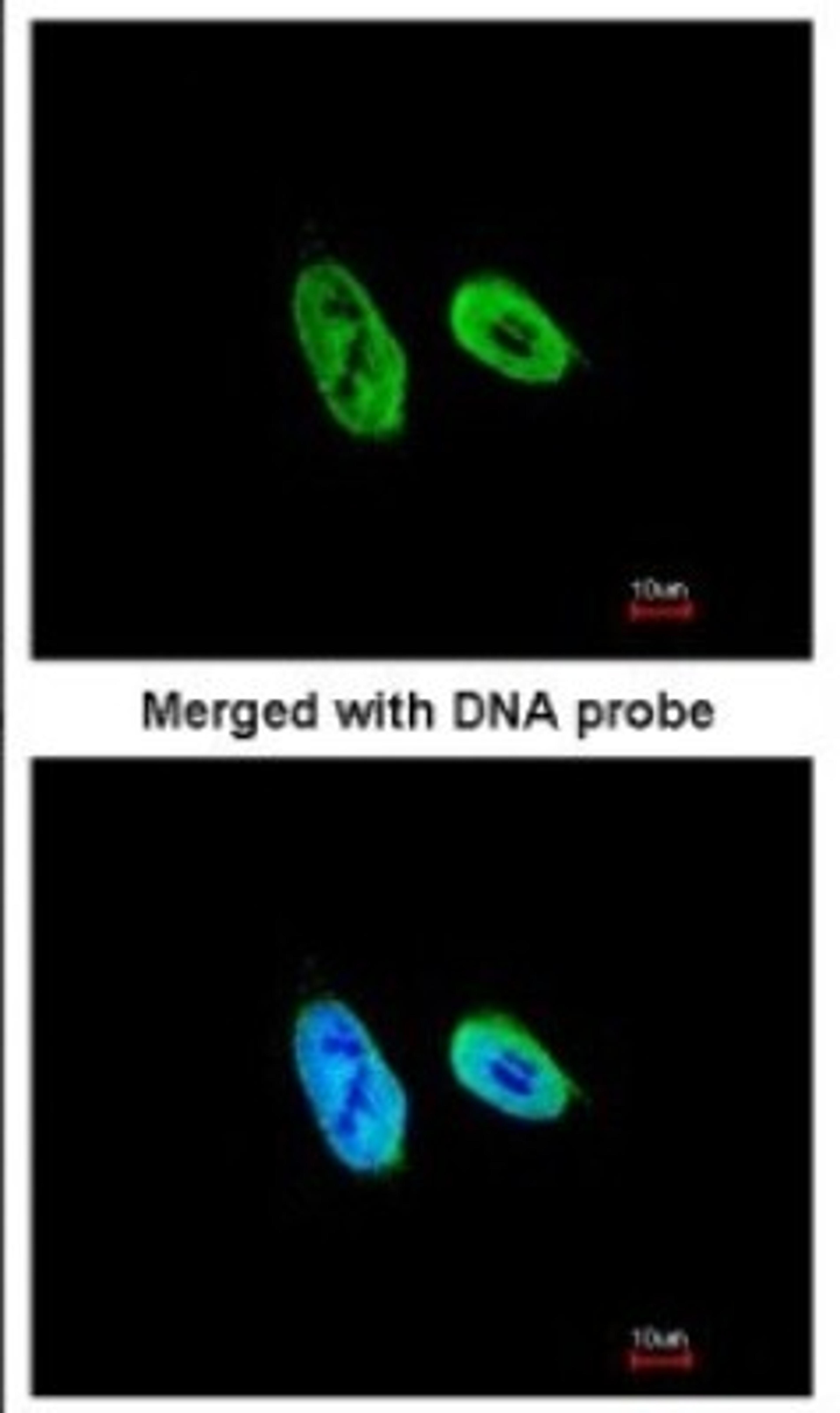 Immunocytochemistry/Immunofluorescence: p27 KIP 1 Antibody [NBP1-32213] - Paraformaldehyde-fixed HeLa, using antibody at 1:200 dilution.