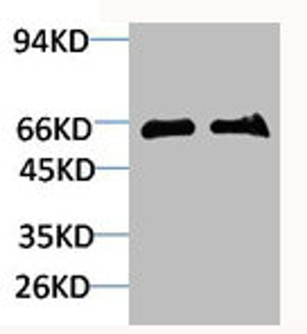 Western blot analysis of 1) Mouse Brain Tissue, 2)Rat Brain Tissue with GABA Transporter 1 Rabbit pAb diluted at 1:2,000.