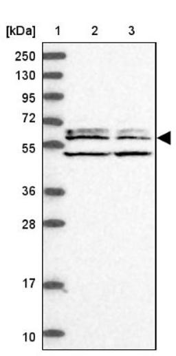 Western Blot: C2orf44 Antibody [NBP1-83612] - Lane 1: Marker [kDa] 250, 130, 95, 72, 55, 36, 28, 17, 10<br/>Lane 2: Human cell line RT-4<br/>Lane 3: Human cell line U-251MG sp