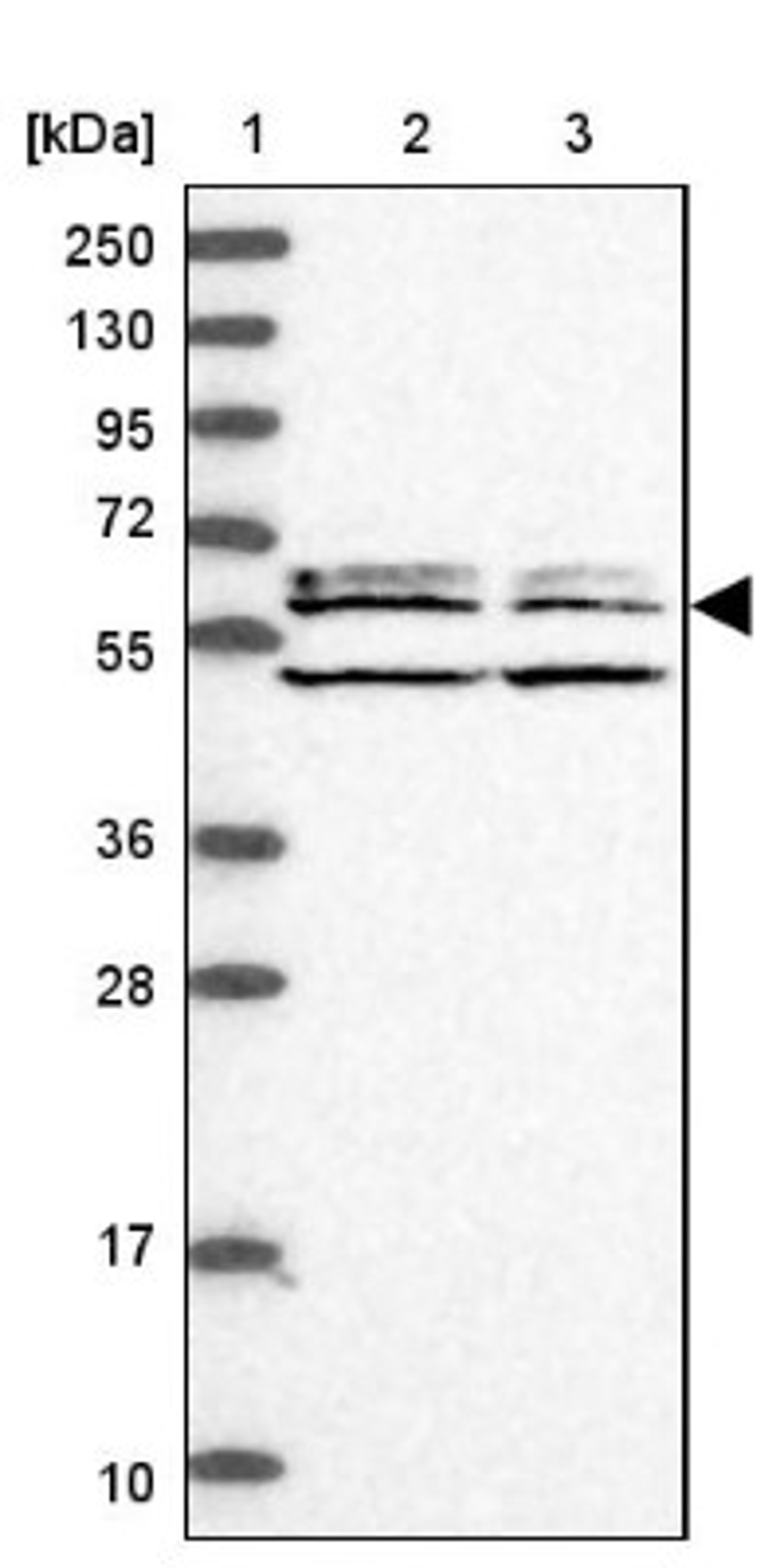 Western Blot: C2orf44 Antibody [NBP1-83612] - Lane 1: Marker [kDa] 250, 130, 95, 72, 55, 36, 28, 17, 10<br/>Lane 2: Human cell line RT-4<br/>Lane 3: Human cell line U-251MG sp