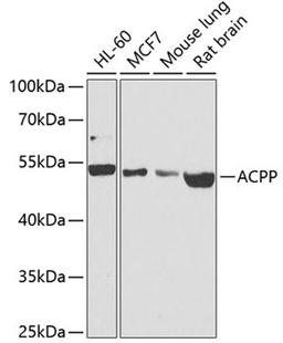 Western blot - ACPP antibody (A1937)