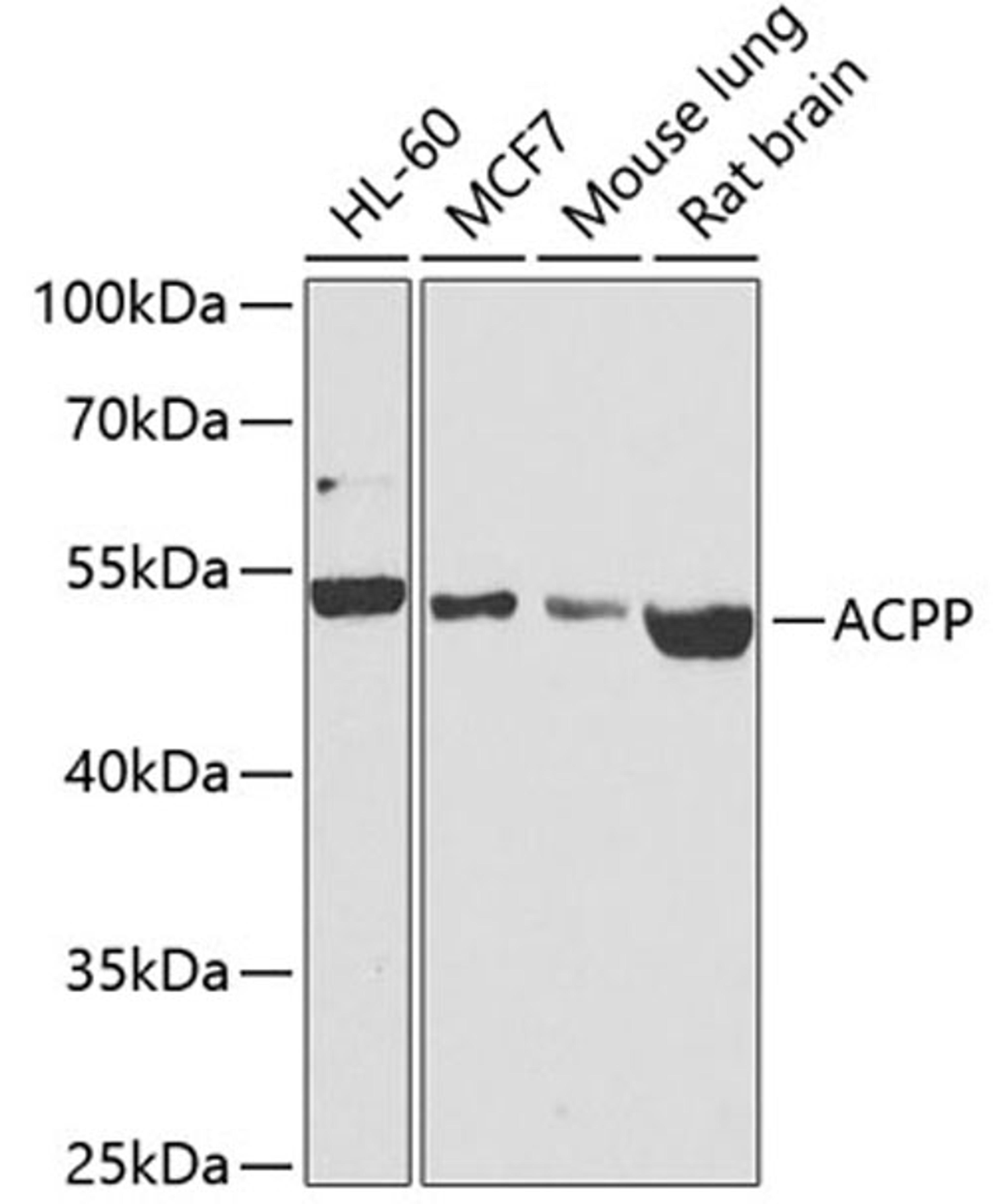 Western blot - ACPP antibody (A1937)