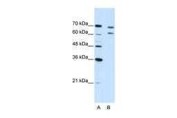 Antibody used in WB on Human Jurkat 5.0 ug/ml.