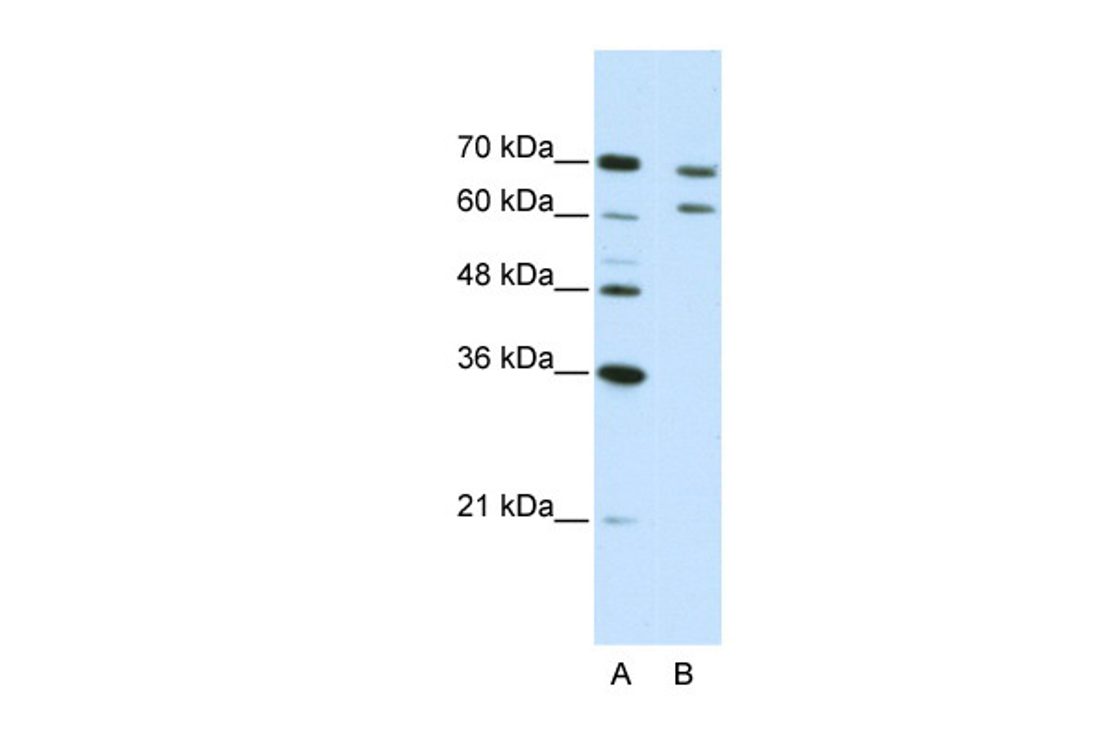 Antibody used in WB on Human Jurkat 5.0 ug/ml.