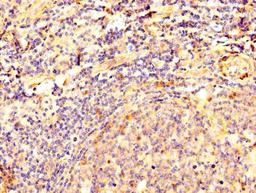 IHC image of CSB-PA007205LA01HU diluted at 1:500 and staining in paraffin-embedded human tonsil tissue performed on a Leica BondTM system. After dewaxing and hydration, antigen retrieval was mediated by high pressure in a citrate buffer (pH 6.0). Section was blocked with 10% normal goat serum 30min at RT. Then primary antibody (1% BSA) was incubated at 4&deg;C overnight. The primary is detected by a biotinylated secondary antibody and visualized using an HRP conjugated SP system.