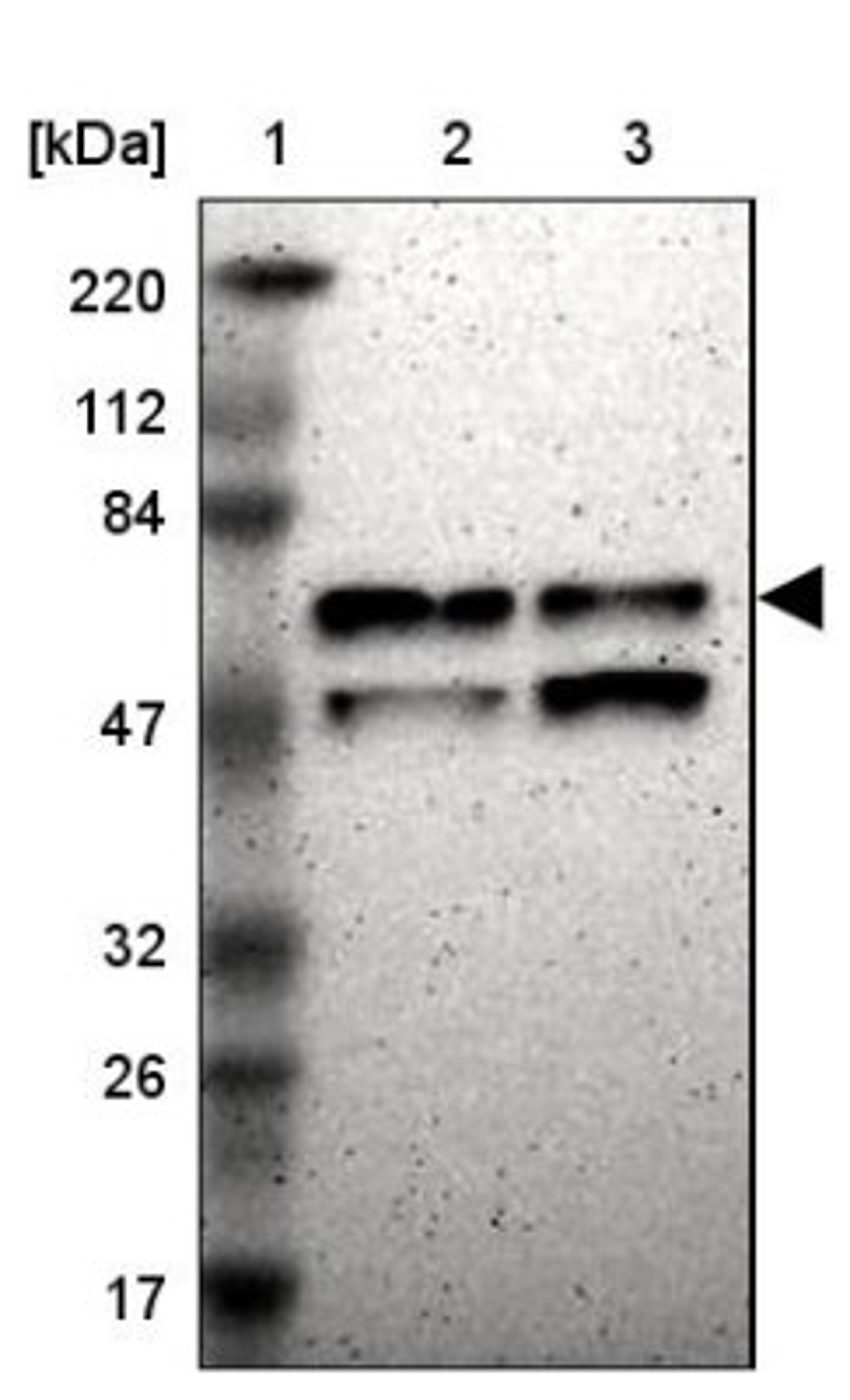 Western Blot: ABLIM3 Antibody [NBP1-81471] - Lane 1: Marker [kDa] 220, 112, 84, 47, 32, 26, 17<br/>Lane 2: Human cell line RT-4<br/>Lane 3: Human cell line U-251MG sp