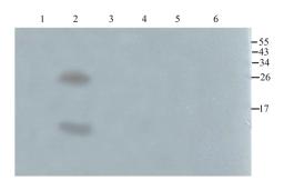 WB analysis of rat brain (lane 1), rat heart (lane 2), rat kidney (lane 3), rat bladder (lane 4), rat colon (lane 5), rat pancreas (lane 6) using SDF1 antibody (1 ug/ml)