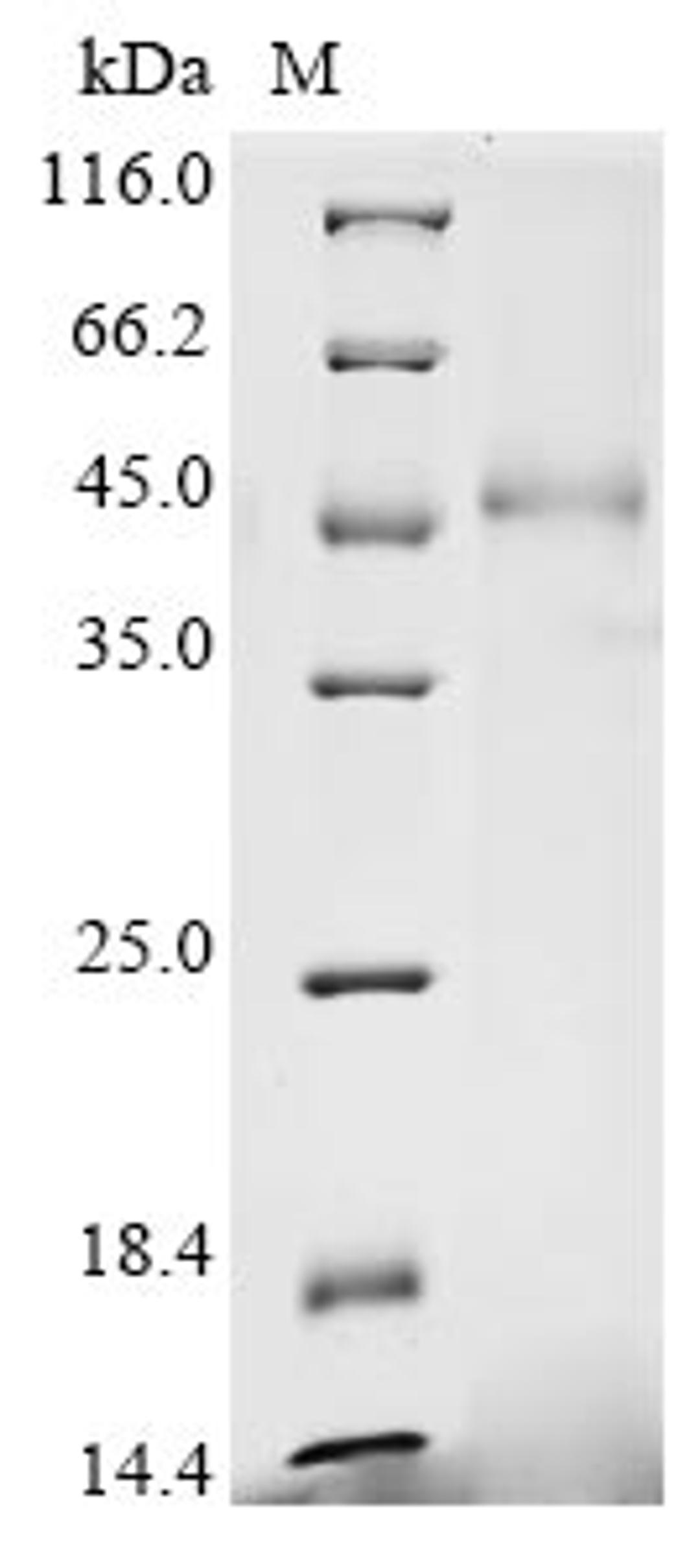 (Tris-Glycine gel) Discontinuous SDS-PAGE (reduced) with 5% enrichment gel and 15% separation gel.