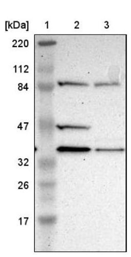 Western Blot: DSN1 Antibody [NBP1-88302] - Lane 1: Marker [kDa] 220, 112, 84, 47, 32, 26, 17<br/>Lane 2: Human cell line RT-4<br/>Lane 3: Human cell line U-251MG sp