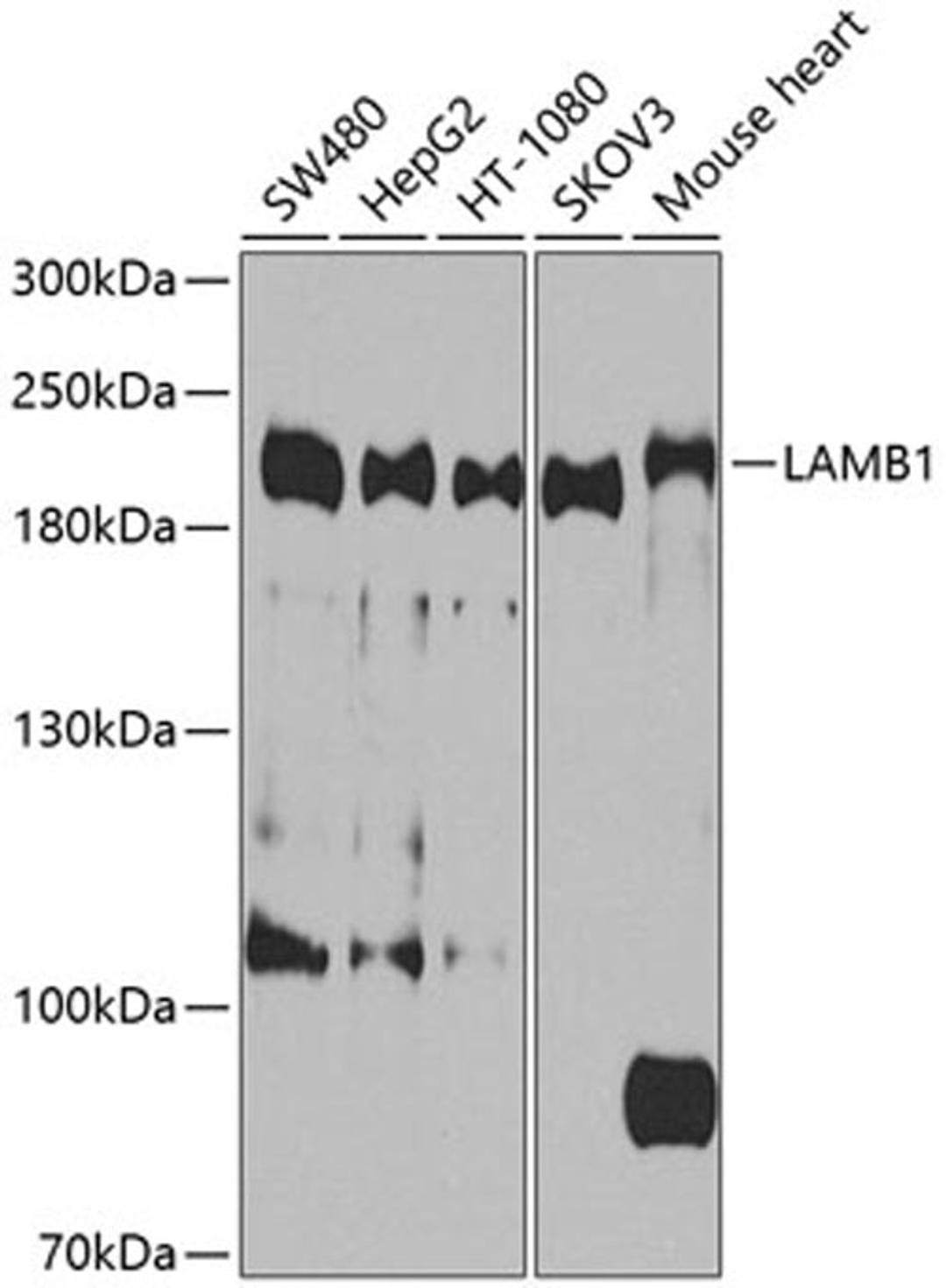 Western blot - LAMB1 antibody (A9827)