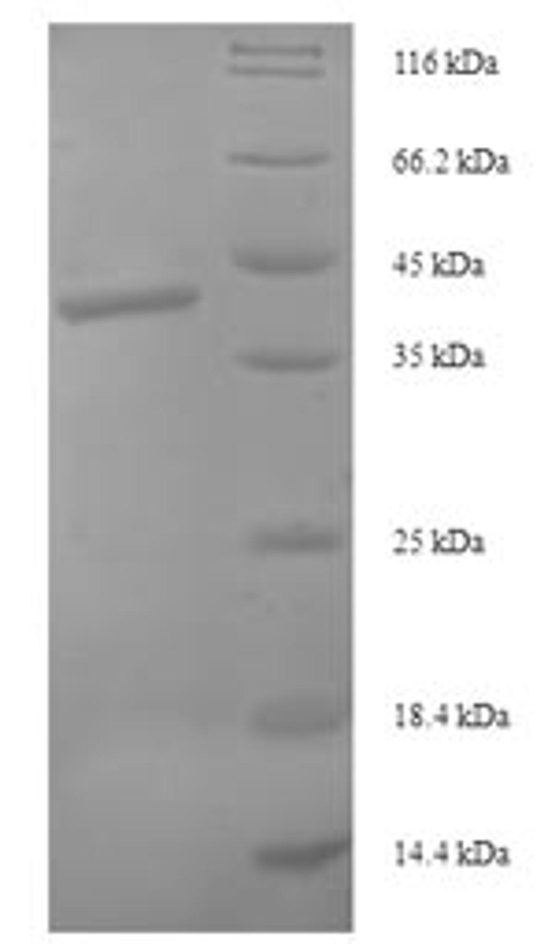 (Tris-Glycine gel) Discontinuous SDS-PAGE (reduced) with 5% enrichment gel and 15% separation gel.