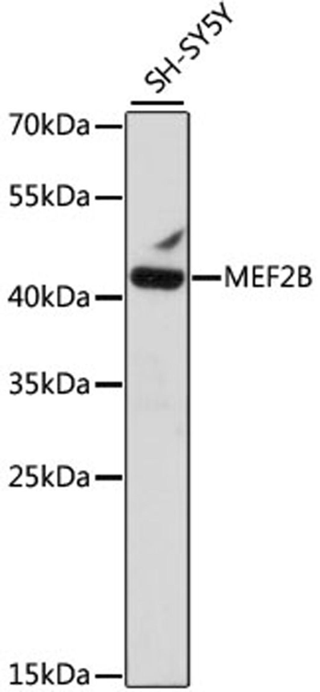 Western blot - MEF2B antibody (A15987)