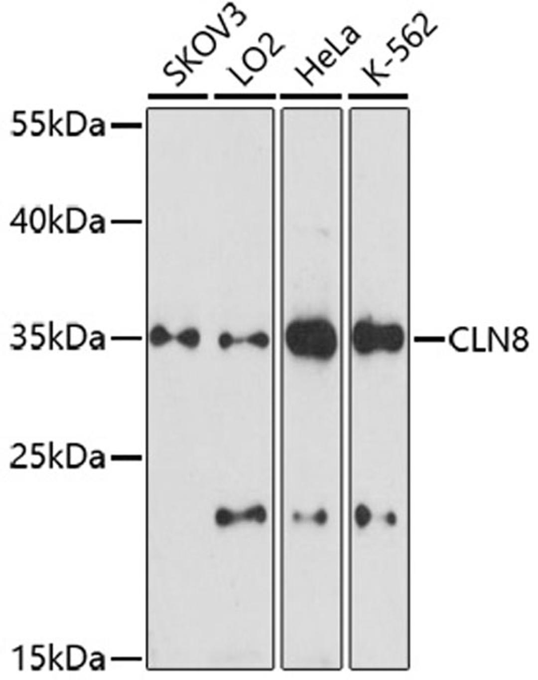 Western blot - CLN8 antibody (A16843)