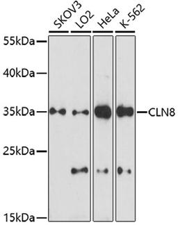 Western blot - CLN8 antibody (A16843)