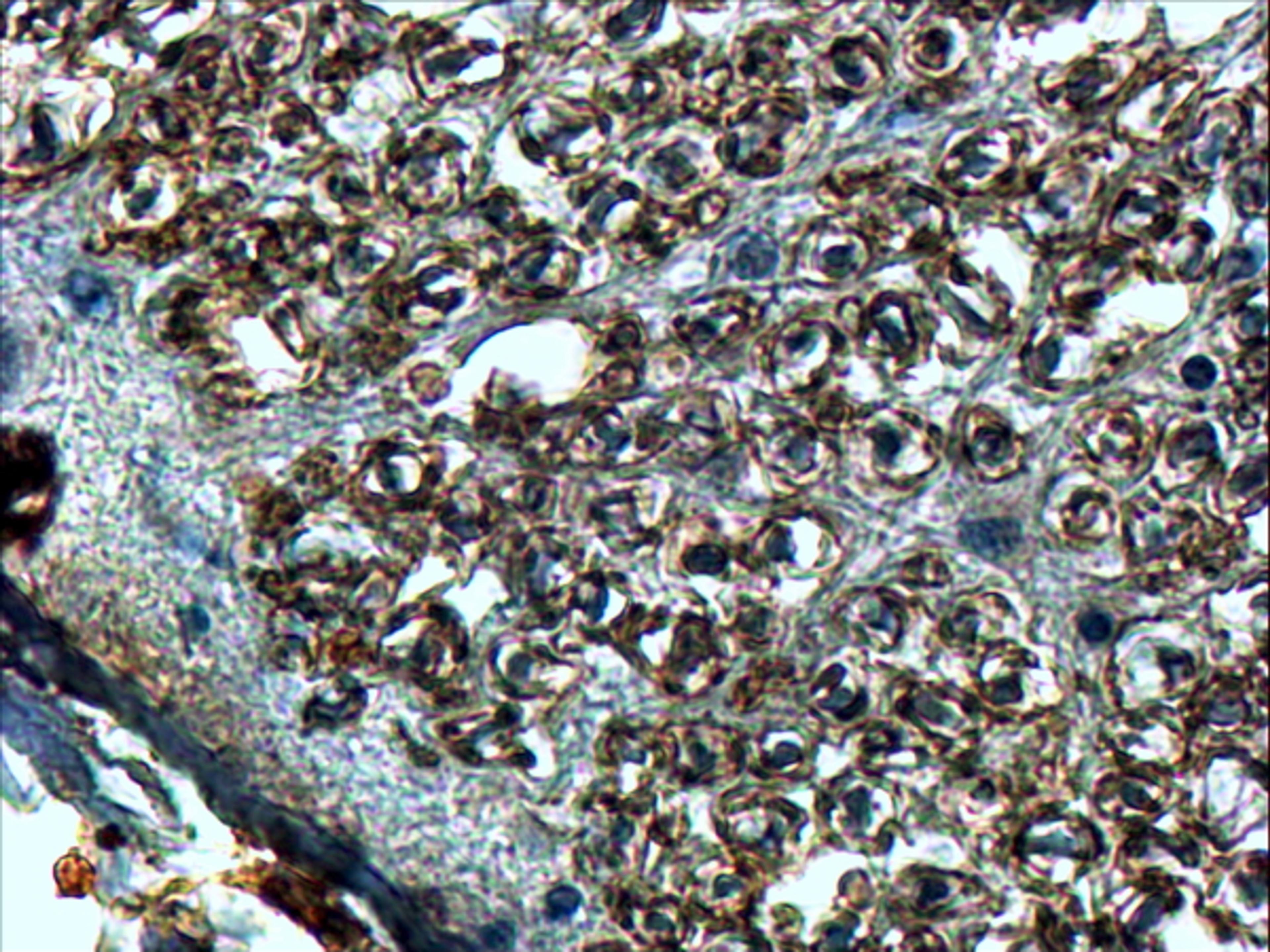 46-381 (4ug/ml) staining of paraffin embedded Human Spinal Cord. Steamed antigen retrieval with Tris/EDTA buffer pH 9, HRP-staining.