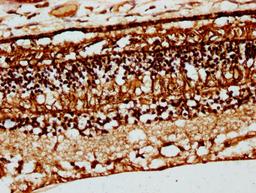 IHC image of CSB-PA005941DSR1HU diluted at 1:66 and staining in paraffin-embedded human eye tissue performed on a Leica BondTM system. After dewaxing and hydration, antigen retrieval was mediated by high pressure in a citrate buffer (pH 6.0). Section was blocked with 10% normal goat serum 30min at RT. Then primary antibody (1% BSA) was incubated at 4&deg;C overnight. The primary is detected by a biotinylated secondary antibody and visualized using an HRP conjugated SP system.