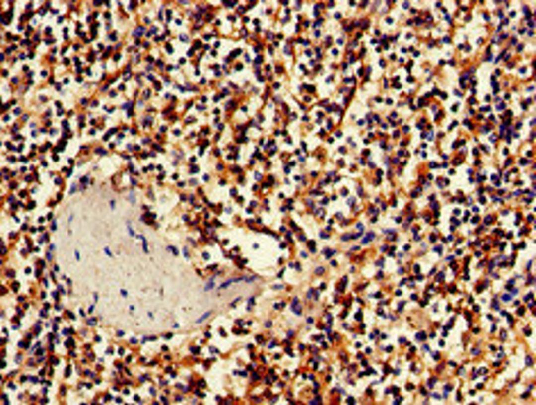 Immunohistochemistry of paraffin-embedded human spleen tissue using CSB-PA845172LA01HU at dilution of 1:100